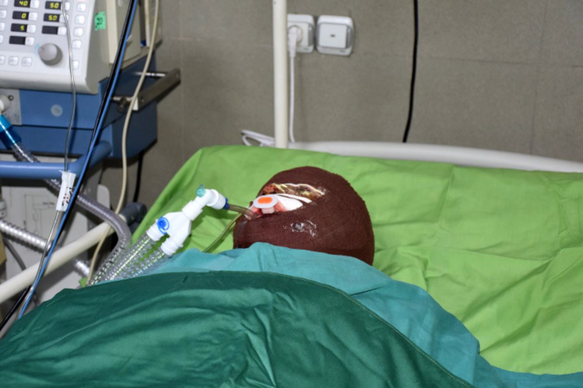 اسیدپاشی به‌خاطر اختلافات ملکی!